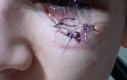 Jugador del Varela Junior golpeó brutalmente a un joven en boliche de Quilmes